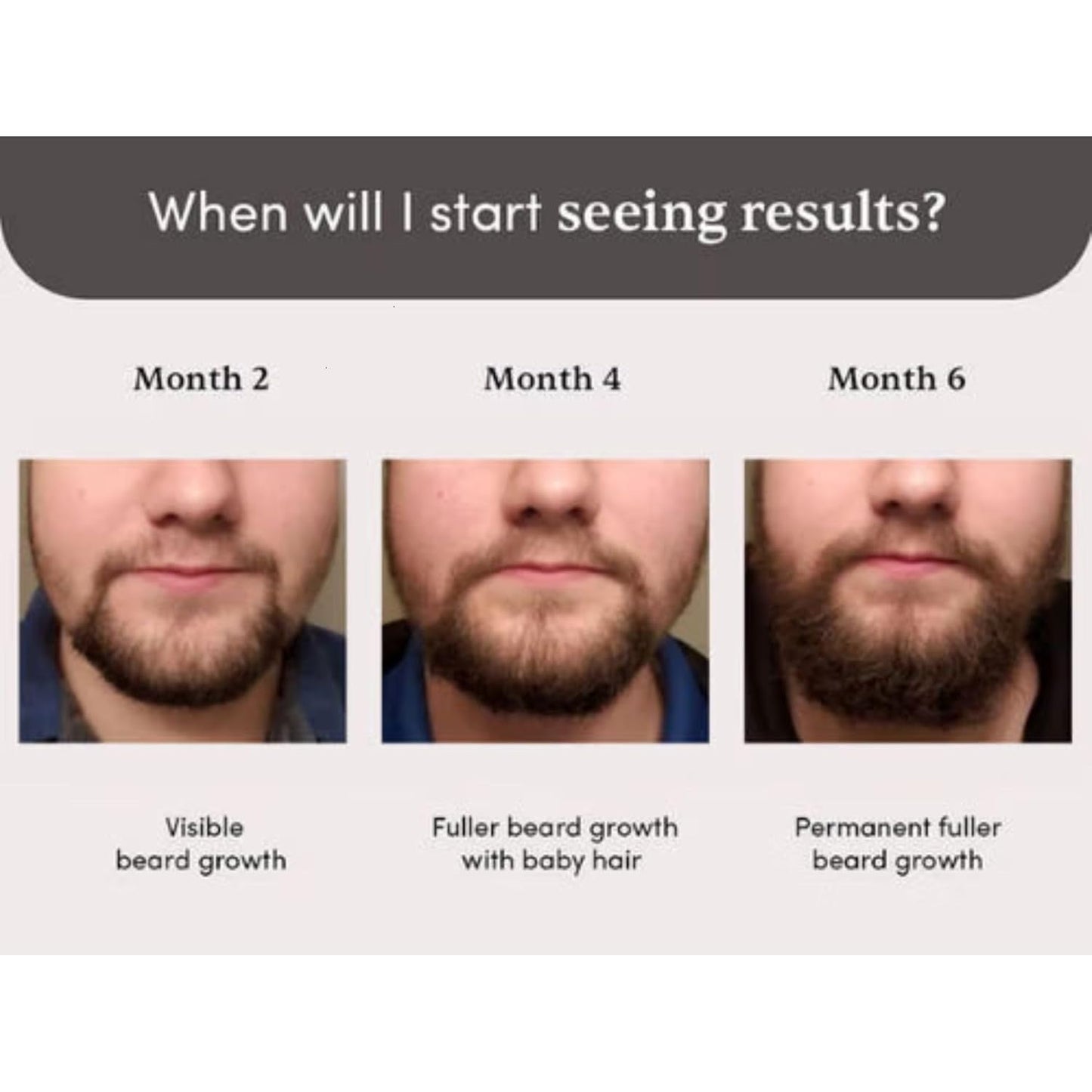 Man Matters Beardmax Growth Serum 30ml | 5% Minoxidil | Activates Beard Follicles | Solves Uneven & Patchy Beard | Alcohol Free